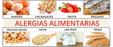 Alergias alimentarias escuelas infantiles